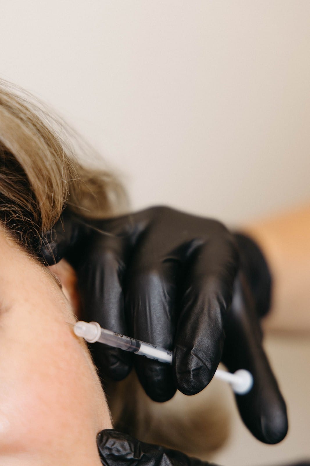 Sculptra & PRF Injections Med Spa Leawood