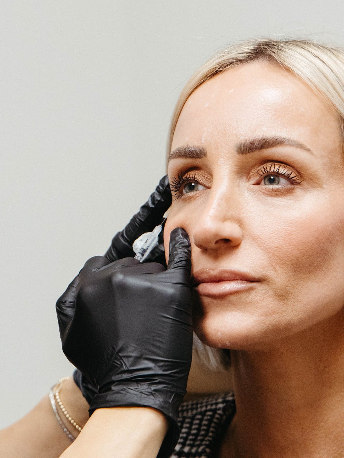 Sculptra & PRF