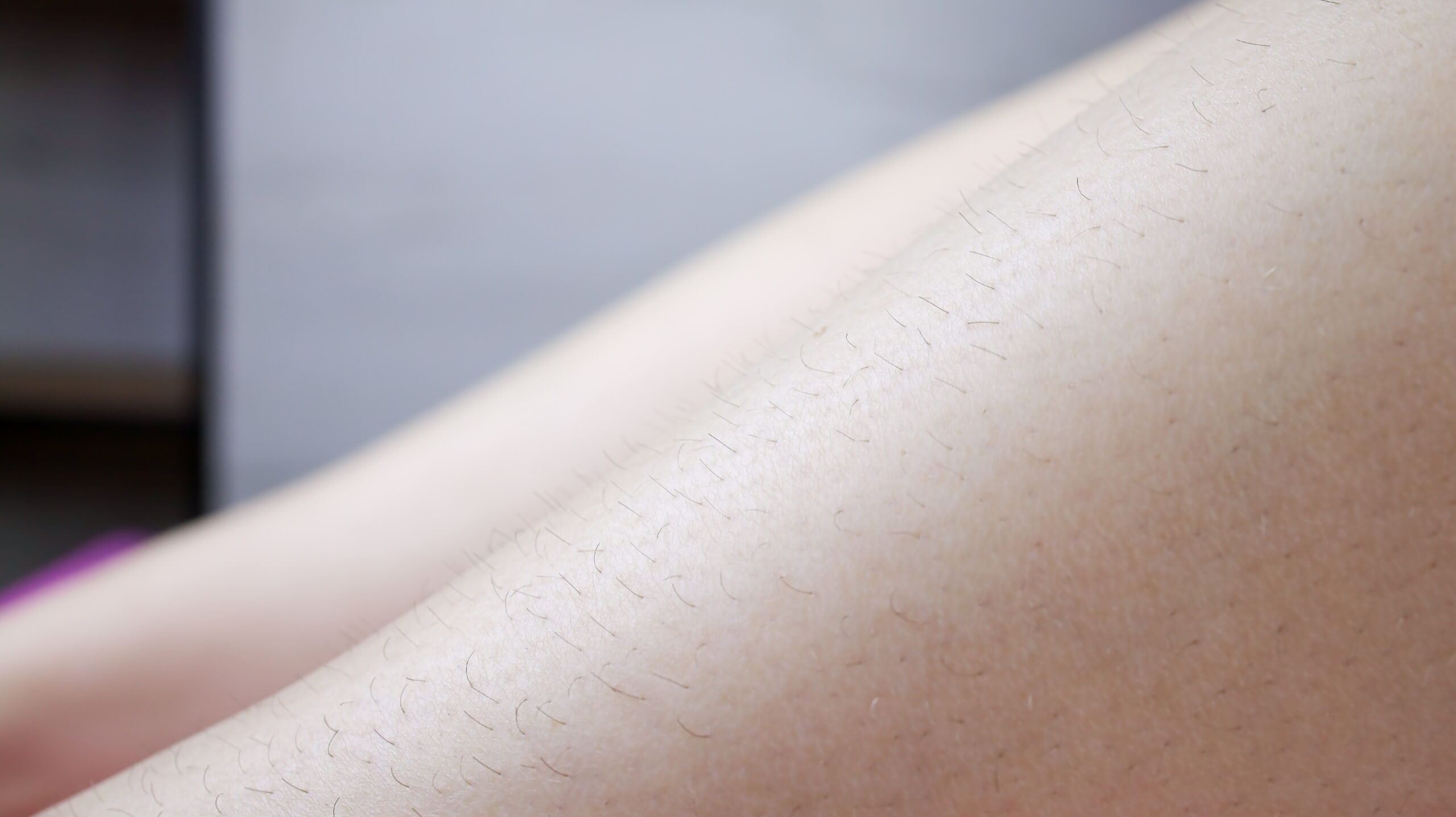 Lower Legs -Laser Hair Removal - Kansas City