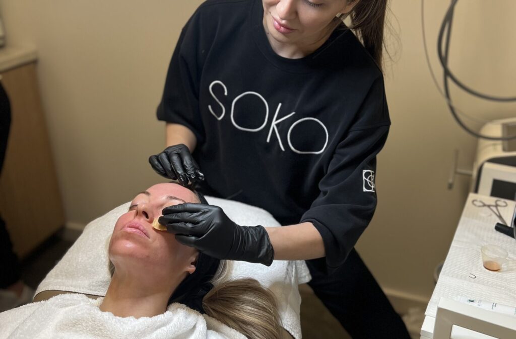 Chemical Peel SOKO Aesthetics & Wellness Kansas City