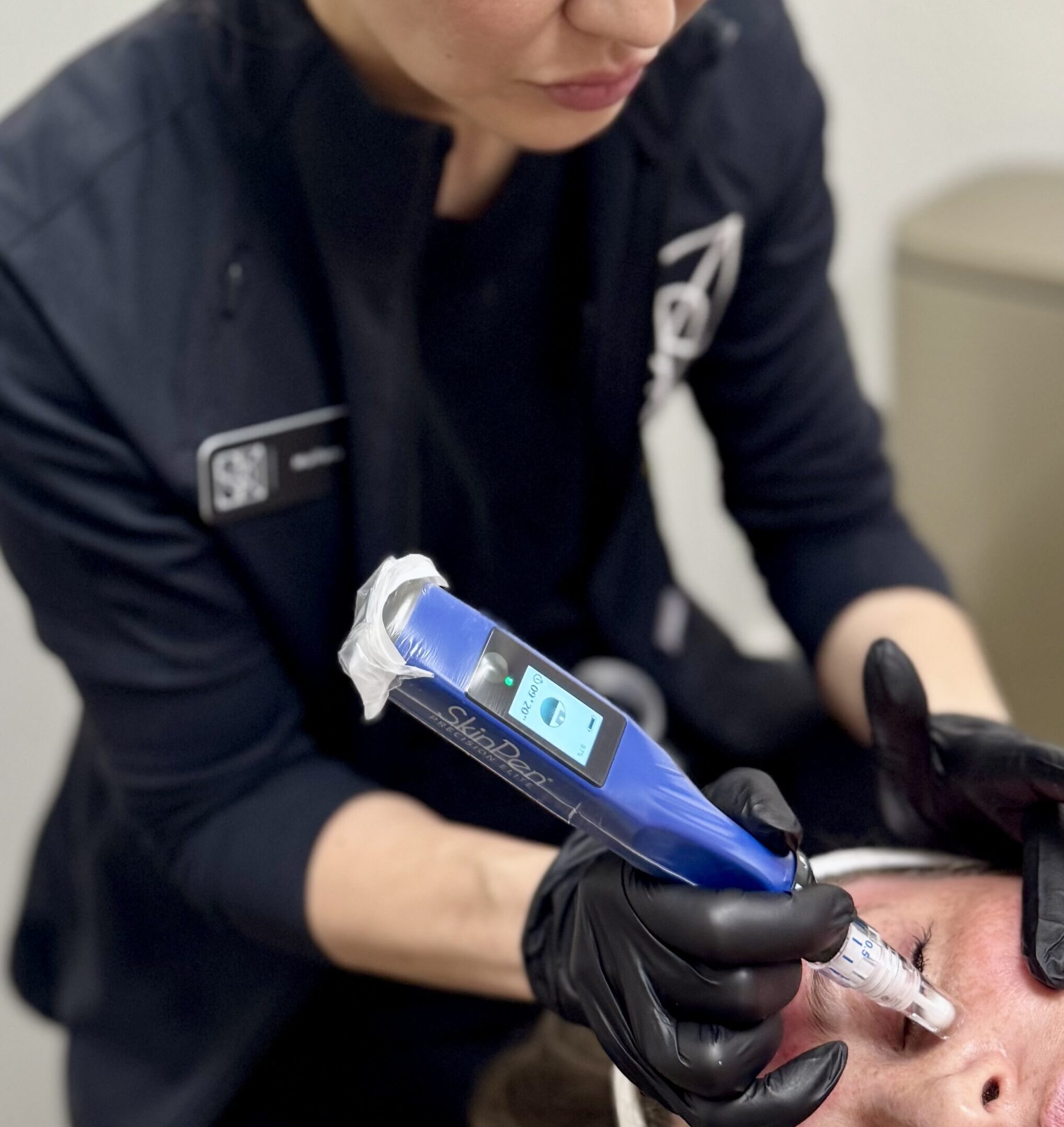 SkinPen Treatment Kansas City