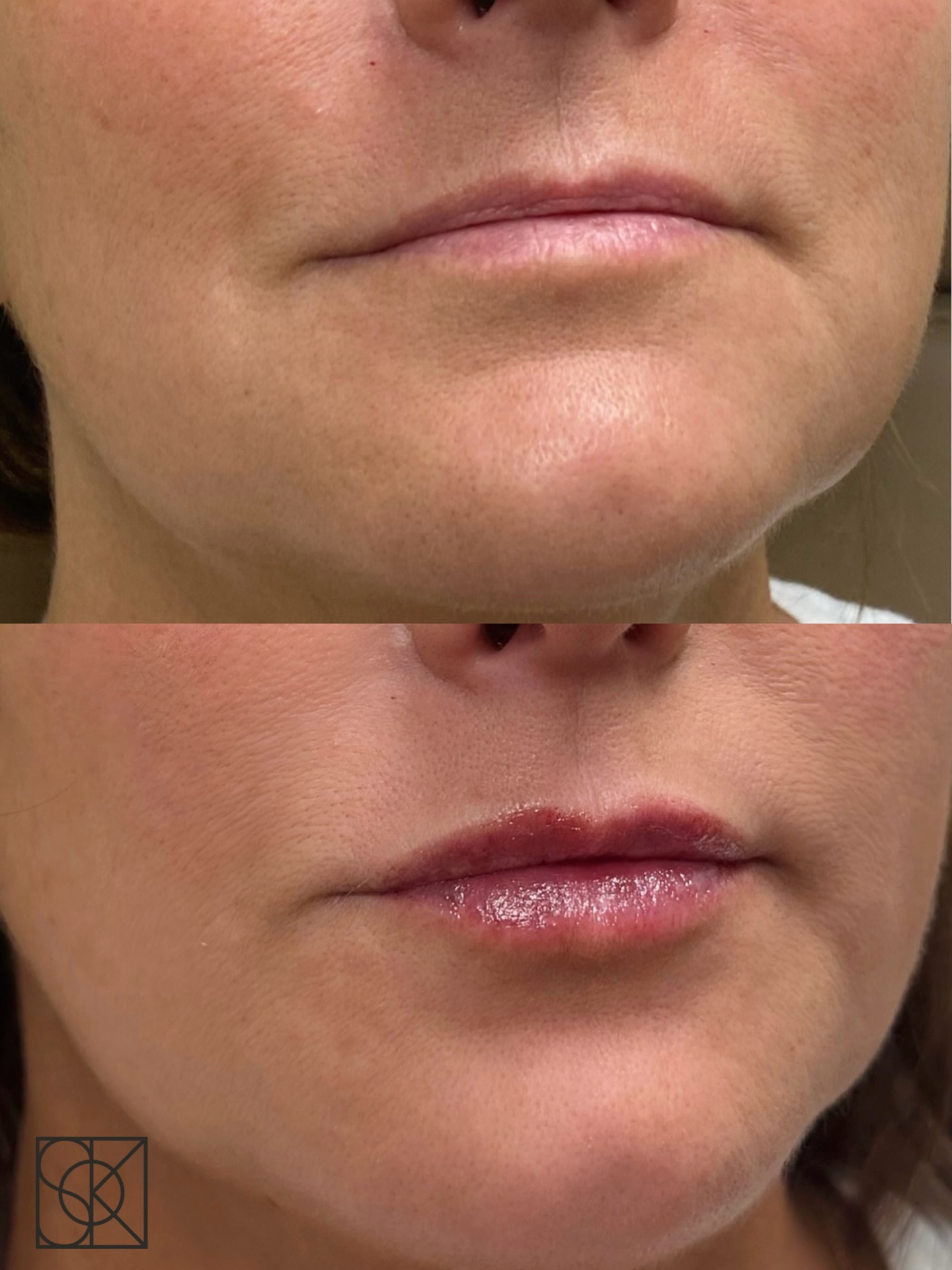 Some of my work this week: 1st photo is a before and after 1