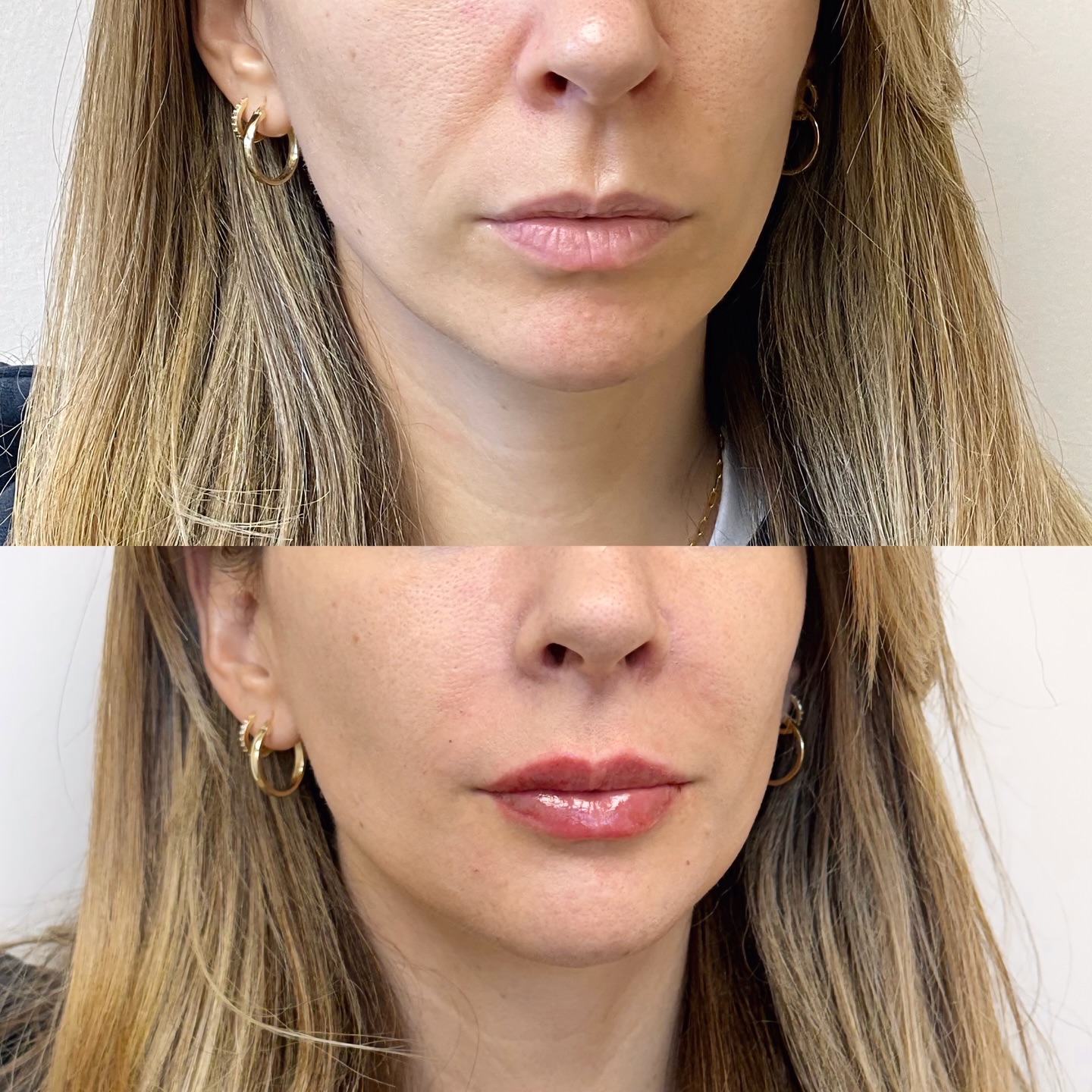 Another SOKO Beauty, enhanced. It’s never just about the lips. 📐💋 We didn’t just